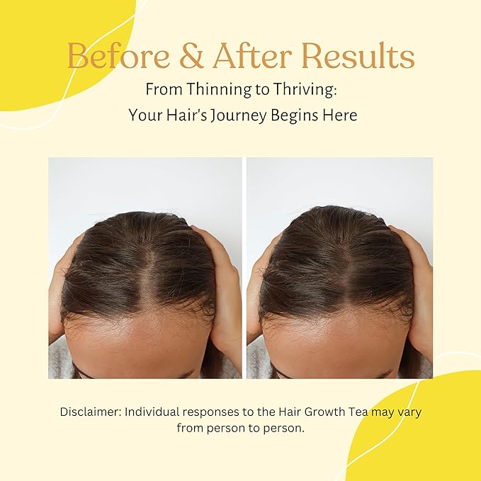 Hair Growth Tea