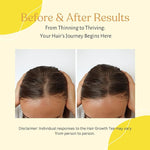 Load image into Gallery viewer, Hair Growth Tea
